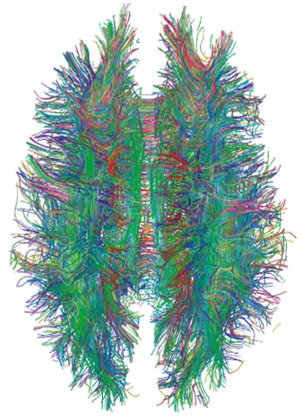 Diffusion tensor imaging of the brain's white matter tracts.